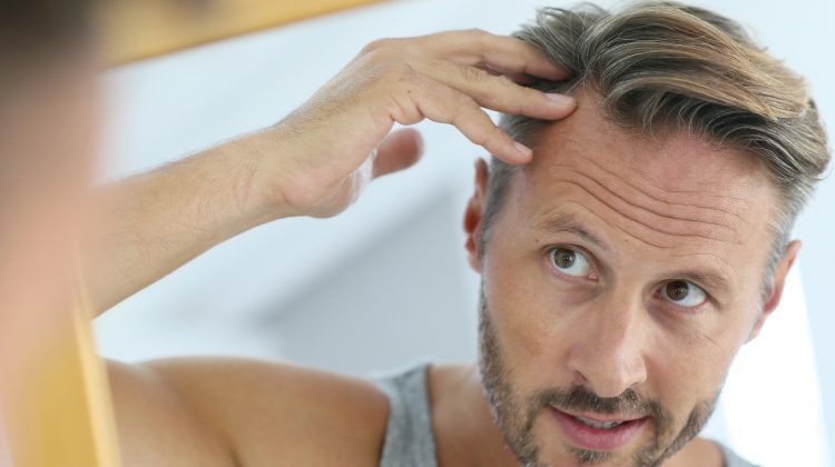 Natural Ways to Reduce Hair Loss - Keep Healthy Naturally